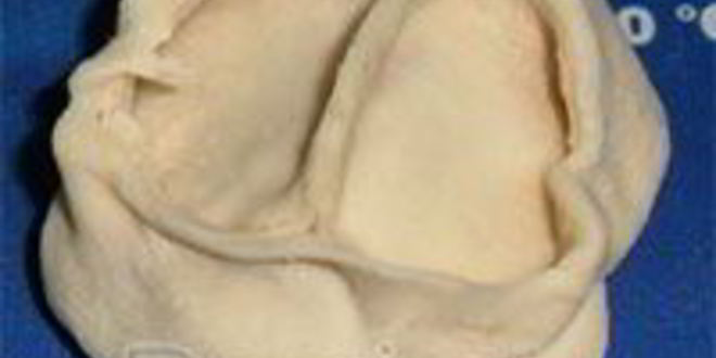 Рецепт мантов узбекских