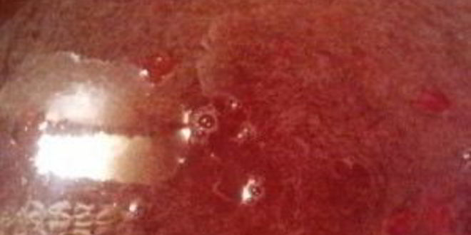 Рецепт кутьи с яблоками