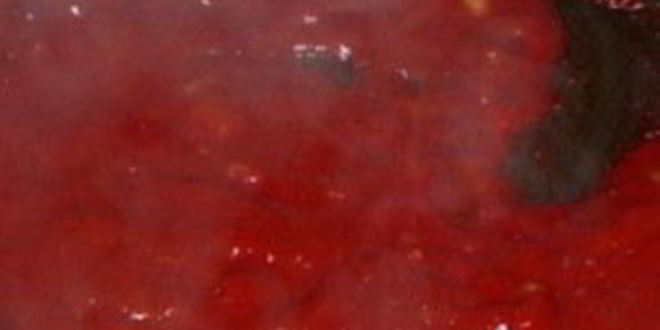 Рецепт бурчака шурпа