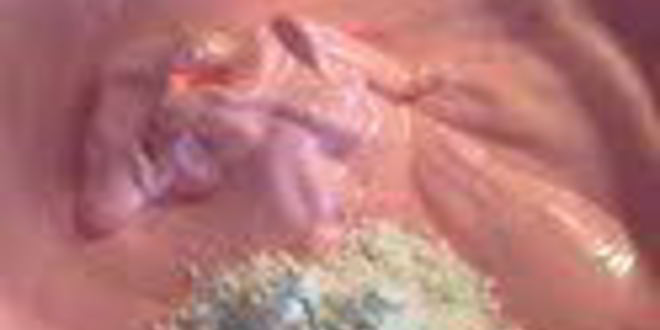 Рецепт шарлотки с запеченным ревенем, баварским фисташковым кремом и клубникой